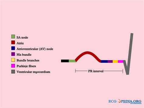 PR interval - wikidoc