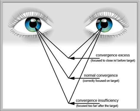 Toradh íomhá ar Convergence Test Pattern