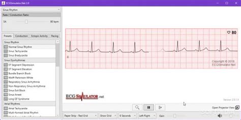 ECG Simulator に対する画像結果