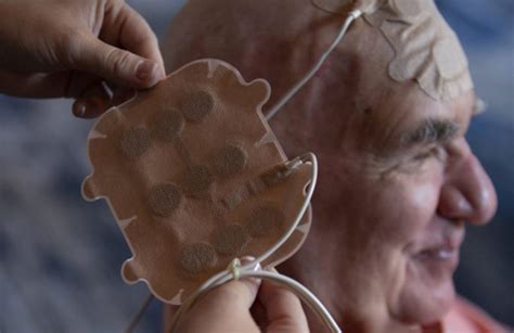 Transducer Array Optune に対する画像結果