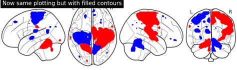 Python Glass Brain に対する画像結果