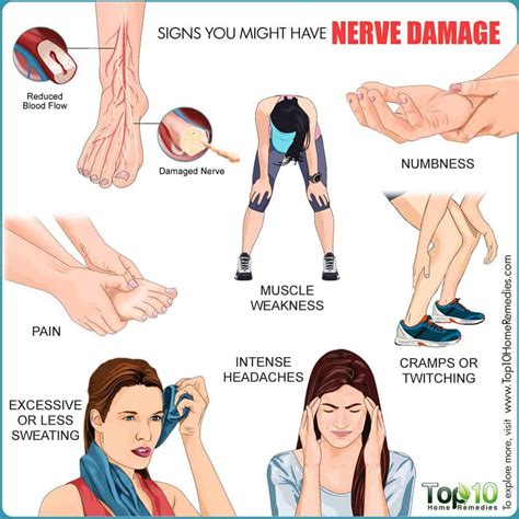 Image result for What Do Shot Nerves Look Like