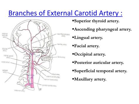 Toradh íomhá ar Common Carteroid Artery
