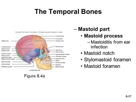 Image result for Mastoid Notch of Temporal Bone