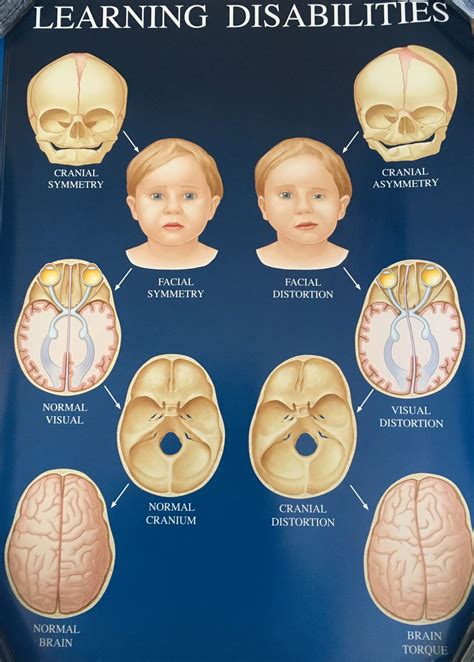 Toradh íomhá ar Learning Disabilities Chart