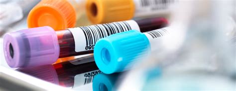 Toradh íomhá ar Complement C3 Production