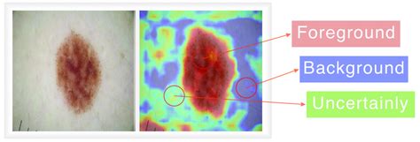 Image result for Unsupervised Learning for Image Segmentation