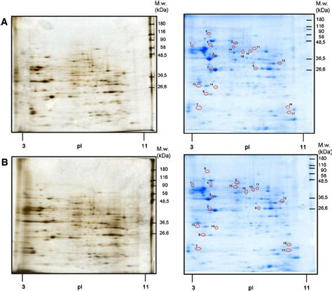 2D Gel Electrophoresis に対する画像結果