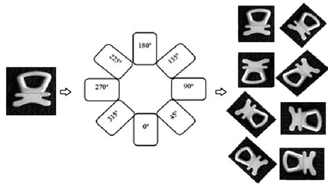 Image result for Internal Rotation Degrees