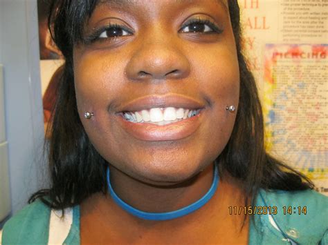 Image result for Cheek Dimples