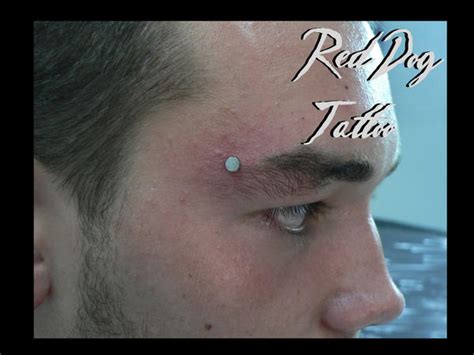 Image result for Face Dermal