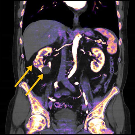 Image result for 4D CT Scan