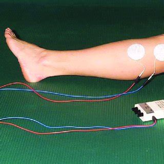 Transcutaneous Electrical Stimulation-এর ছবি ফলাফল