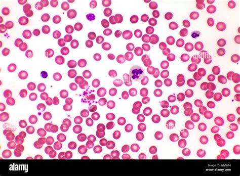 Normal Red Blood Cells Under Microscope-साठीचा प्रतिमा निकाल