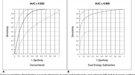 Toradh íomhá ar Dual-Energy Subtraction Algorithm