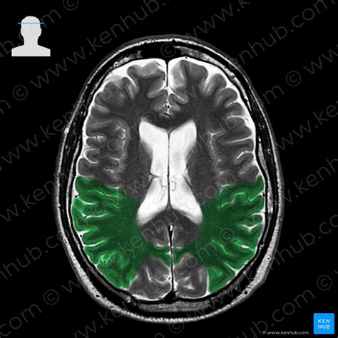 Afbeeldingsresultaten voor Frontal Cortex MRI Normal Side View