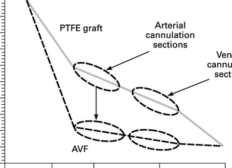 Image result for Negative Deflection AVF