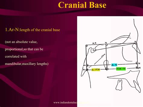 Image result for Perpendicular Cogs
