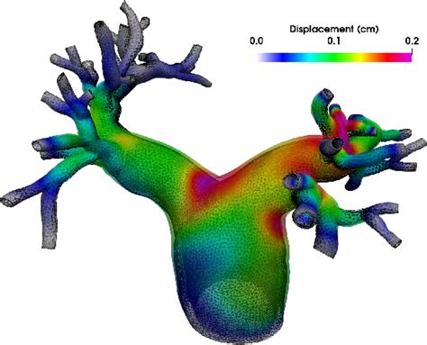 Image result for Fluid Structure Interaction Blood Flow