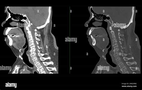 Image result for 4D Neck CT
