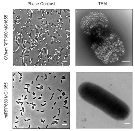 Phase Contrast Microscopy に対する画像結果