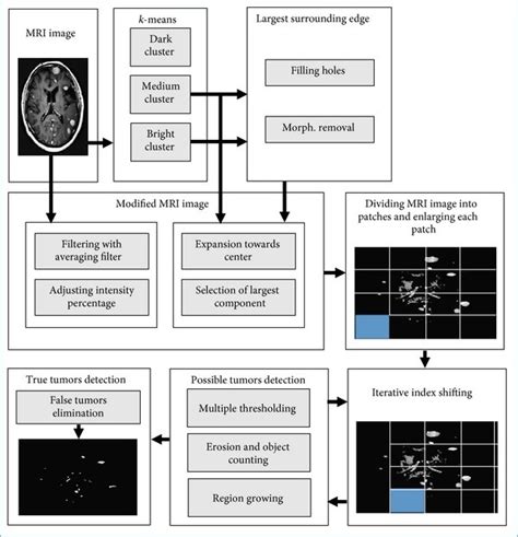 Image result for MRI Spatial Localization