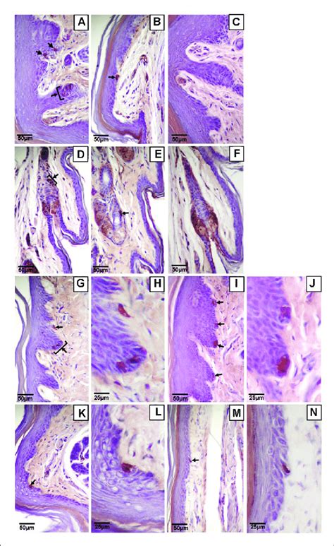Afbeeldingsresultaten voor Merkel Cell Light Microscopy