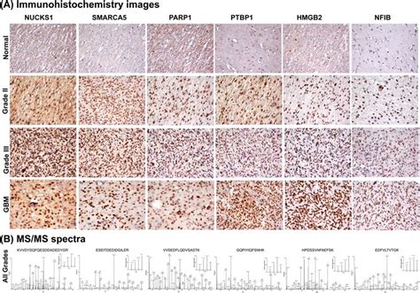 Image result for Cosmic Tissu Microarray Spatial