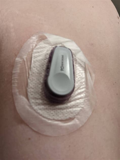 Image result for Dexcom G6 Over Cover