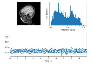 Afbeeldingsresultaten voor Set Xlabel Matplotlib