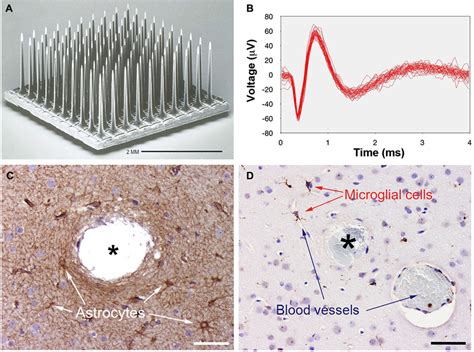Utah Microelectrode Array に対する画像結果