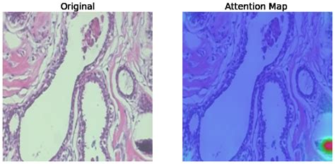 Afbeeldingsresultaten voor Python Code Attention Map for the Image Uploaded