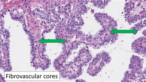 Core Multi Fibious に対する画像結果