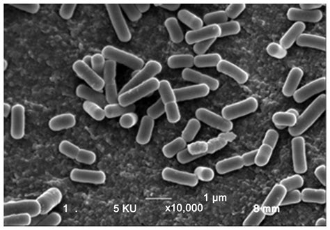 Image result for Lactobacillus Microscope