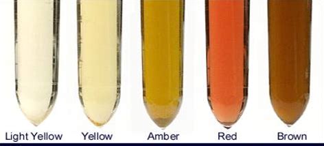 Macroscopic Urine Test に対する画像結果