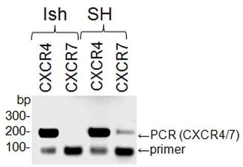 Reverse Transcriptase PCR Primer Design に対する画像結果