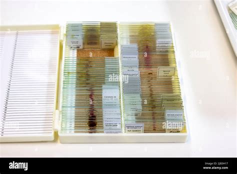 Bacteria Microscope Slides に対する画像結果