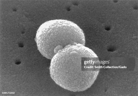 Image result for Strep Gram-positive