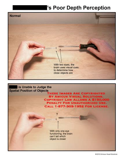 Image result for Poor Depth Perception