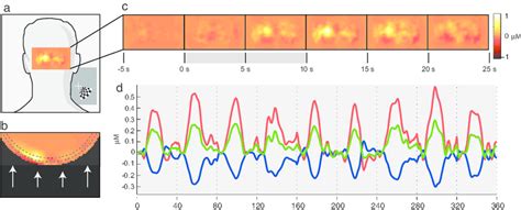 Visual Cortex Activation Map Surface に対する画像結果
