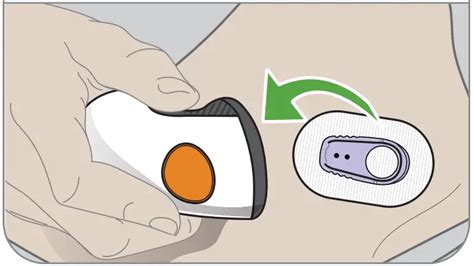 Image result for Dexcom Schematics