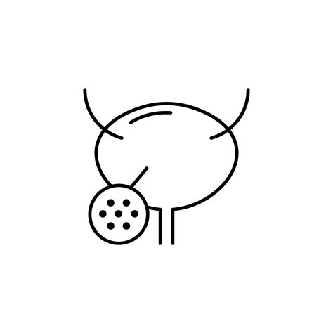 Image result for Cystitis Diagram