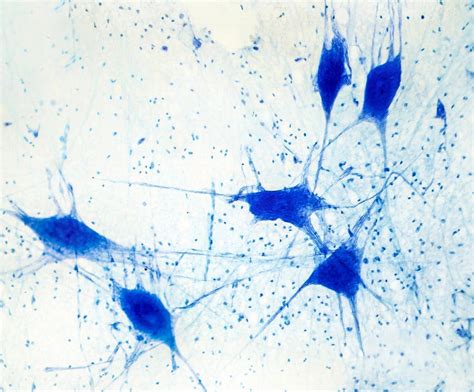 Image result for Neuron Light Microscope