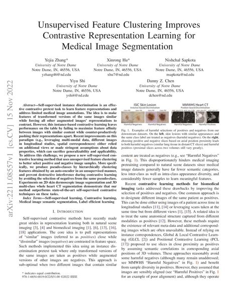 Image result for Unsupervised Learning for Image Segmentation