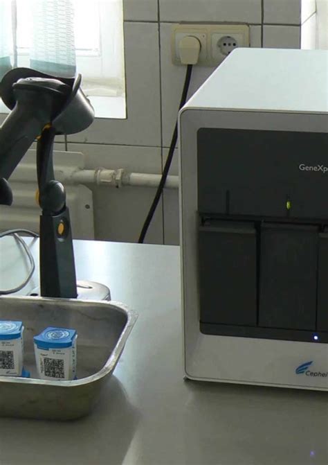 Toradh íomhá ar GeneXpert TB Diagnosis