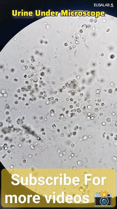 Image result for Mickey Mouse Urine Microscope