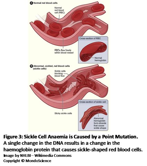 Image result for Gene Mutation Examples