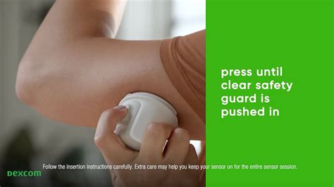 Afbeeldingsresultaten voor Dexcom Sensor Placement