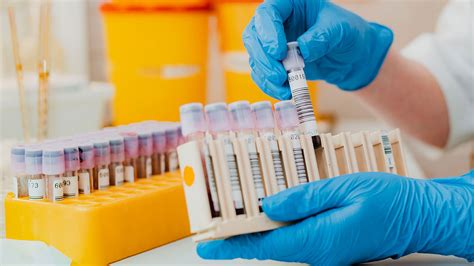 Image result for Path Lab Blood