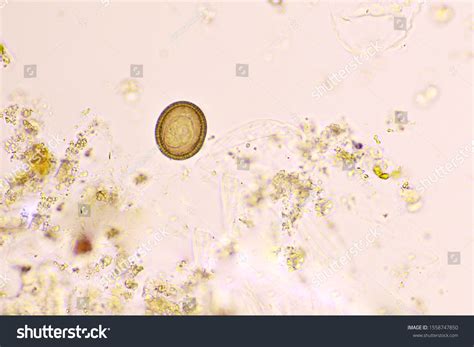 Parasitic Worm Eggs Human Stool に対する画像結果